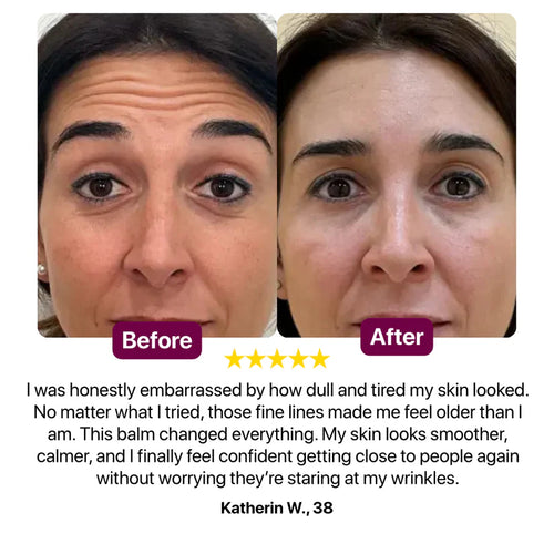 Anti Wrinkle Calcium Multi Balm