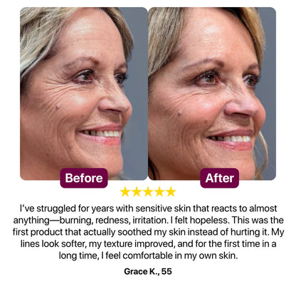 Anti Wrinkle Calcium Multi Balm