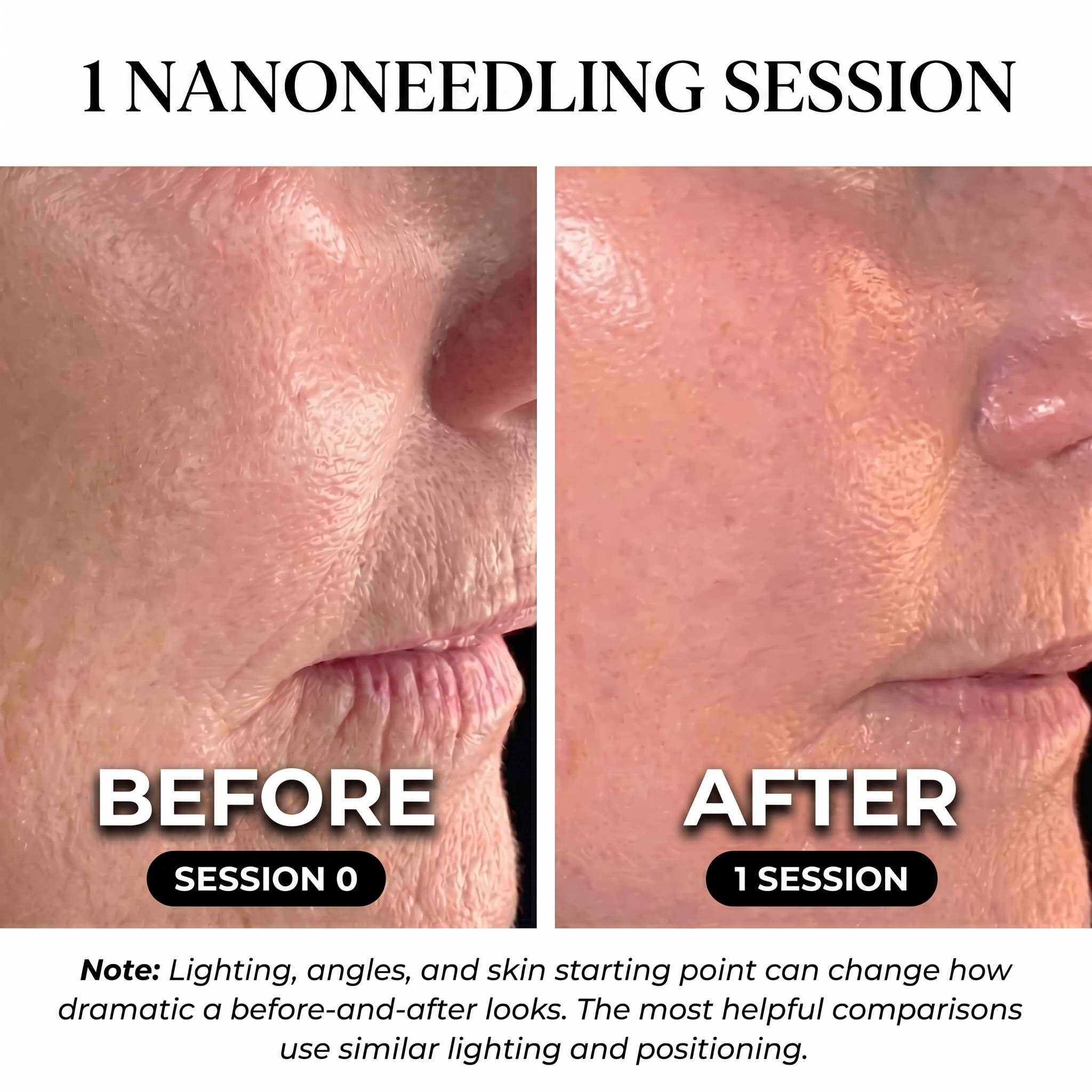 Sylairé Nano Precision Skin Renewal kit